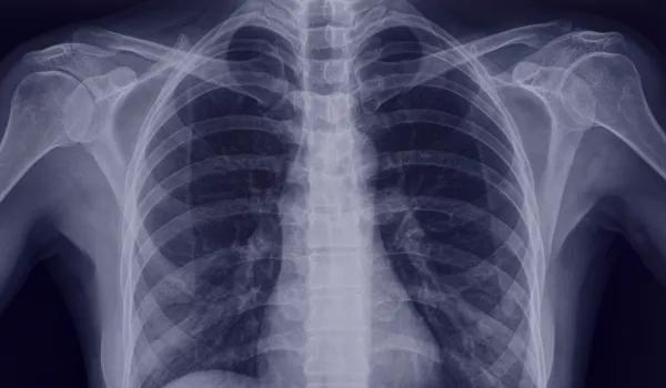 Imaging task force image