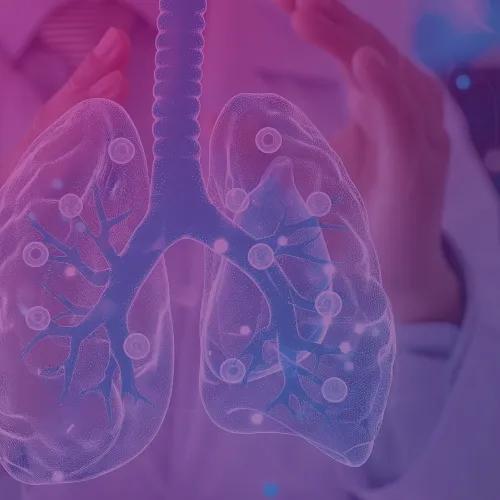 Image of lungs